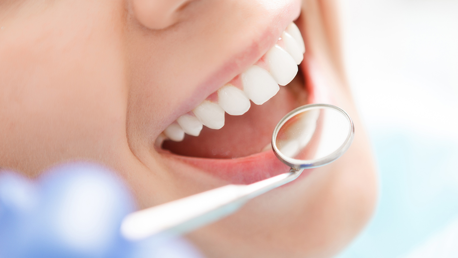 Teeth Whitening Services, Teeth Whitening 101